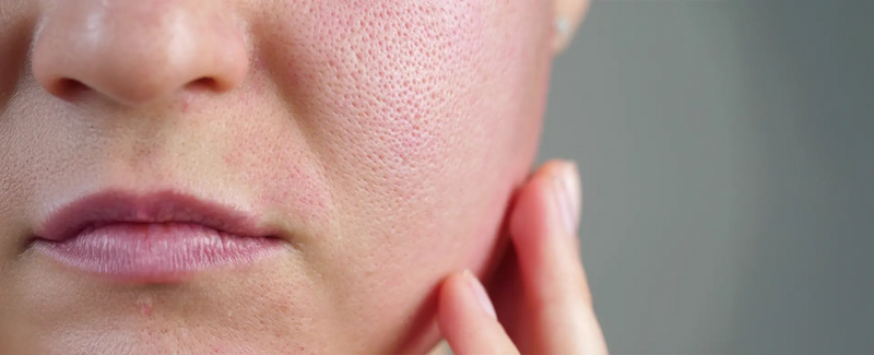 Best Face Primer for Long-Lasting Makeup