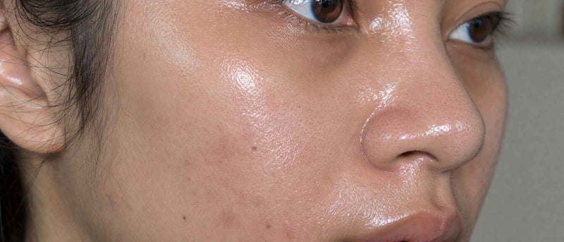 Face Primer for Oily Skin: How to Control Shine Without Dryness?